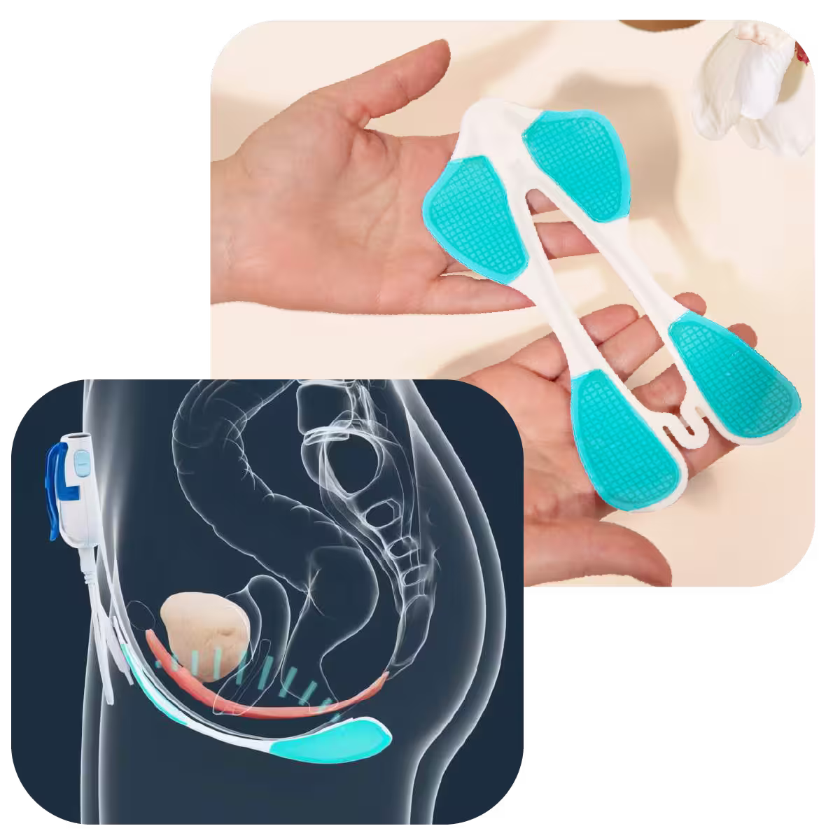 Elitone controller and gel pad product image